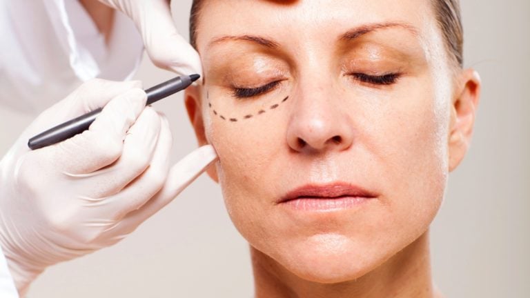 Blefaroplastia: olhar mais jovem e renovado