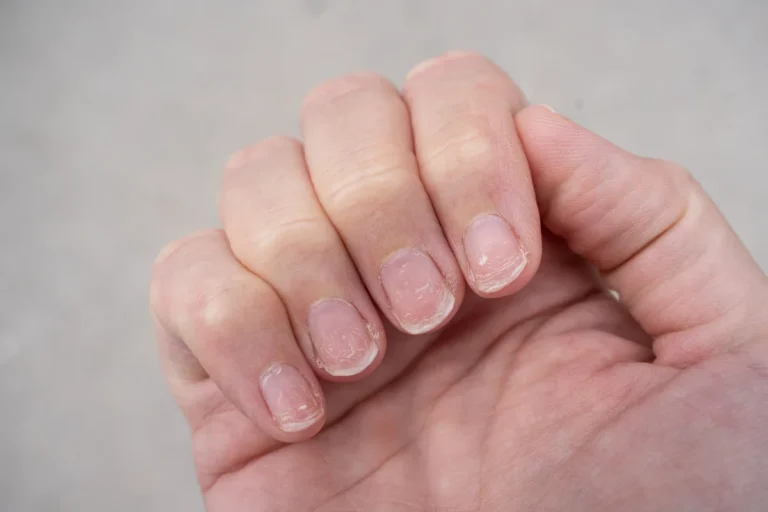 Imagem de capa representando o destaque: Como nossas unhas podem dar sinais sobre nossa saúde