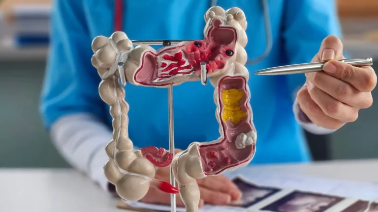 Imagem de capa representando o destaque: Sinas e prevenção contra o câncer colorretal