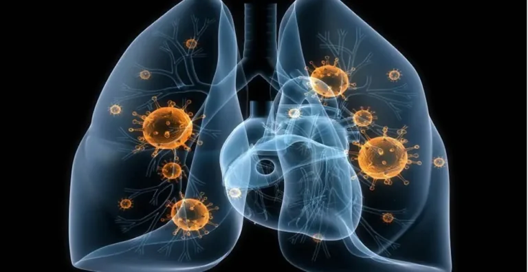 Imagem de capa representando o destaque: Tuberculose: sintomas transmissão e sinais de alerta